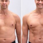 How to Lose Belly Fat for Men