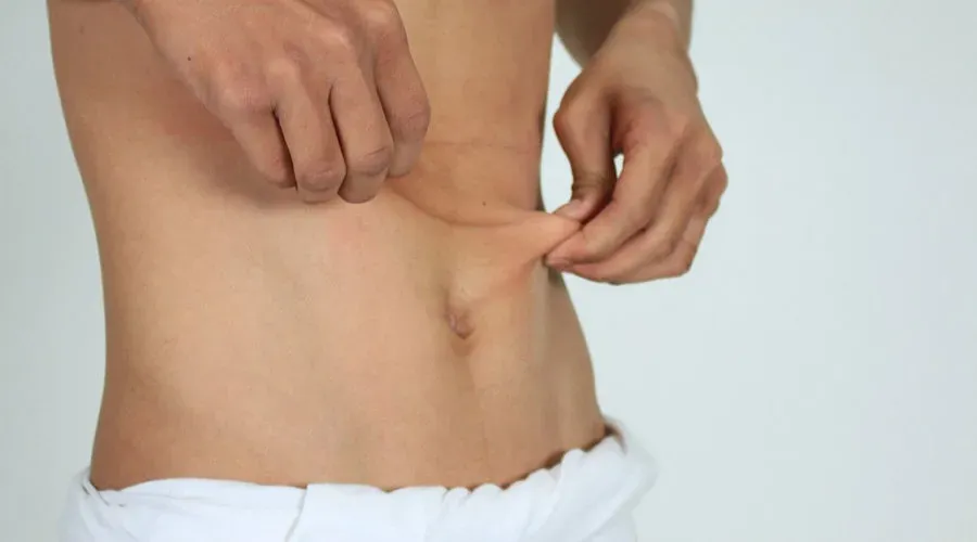 How to Reduce Belly Fat Without Exercise